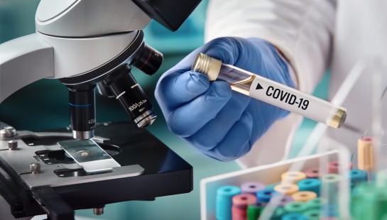 PERIODOS, PREVENCIÓN Y PATOLOGÍA DE LA COVID-19